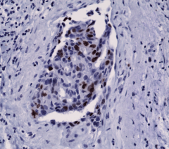 Anti-KI67 Rabbit Monoclonal Antibody, Clone RM227 image 1