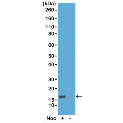 Anti-Phospho-Histone H3 (Thr6) rabbit monoclonal antibody [RM160] image 1