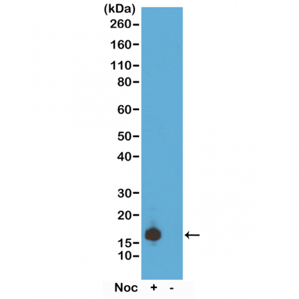 Anti-Phospho-Histone H3 (pSer10) rabbit monoclonal antibody [RM163] image 2