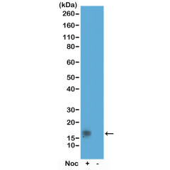 Anti-Phospho-Histone H3 (Thr11) rabbit monoclonal antibody [RM164] image 1