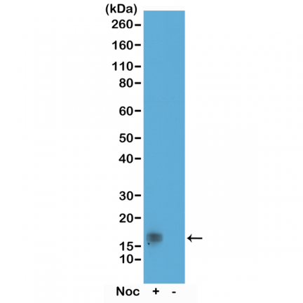 Anti-Phospho-Histone H3 (Thr11) rabbit monoclonal antibody [RM164] image 1
