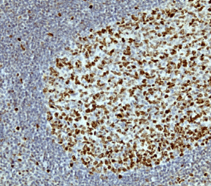 Anti-KI67 Rabbit Monoclonal Antibody, Clone RM227 image 2