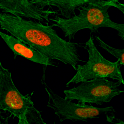Anti-Acetyl-Histone H3 (Lys4) rabbit monoclonal antibody [RM149] image 2