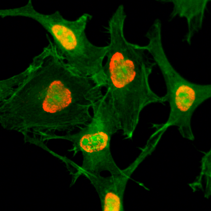 Anti-Acetyl-Histone H3 (Lys79) rabbit monoclonal antibody [RM156] image 1