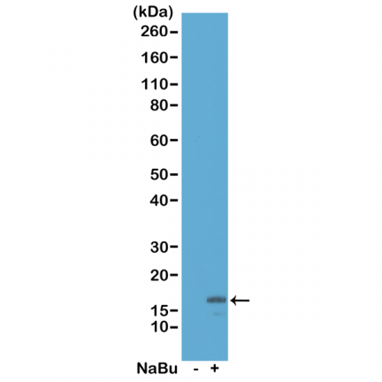 Anti-Acetyl-Histone H3 (Lys18) rabbit monoclonal antibody [RM166] image 2