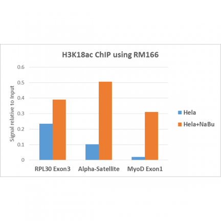 Anti-Acetyl-Histone H3 (Lys18) rabbit monoclonal antibody [RM166] image 3