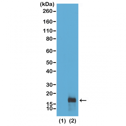 Anti-Dimethyl Histone H3 (Lys79) rabbit monoclonal antibody [RM181] image 1