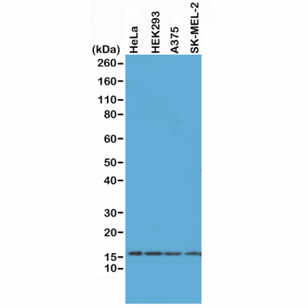 Anti-Histone H2AX rabbit monoclonal antibody [RM214] image 2