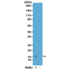 Anti-Acetyl-Histone H2A.Z (Lys7) rabbit monoclonal antibody [RM222] image 1