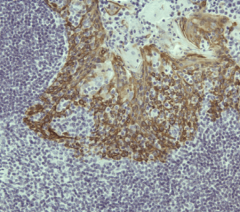 Anti-Cytokeratin 5 Rabbit Monoclonal Antibody, Clone RM226 image 1