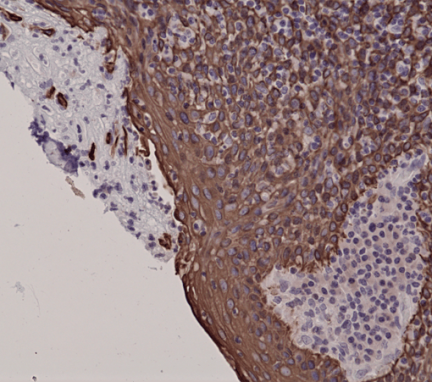 Anti-Cytokeratin 5 Rabbit Monoclonal Antibody, Clone RM226 image 3