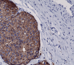 Anti-HER2 (c-erbB-2) Rabbit Monoclonal Antibody, Clone RM228 image 1
