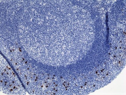 Biotin Anti-Human IgA2 rabbit monoclonal antibody [RM125] image 1