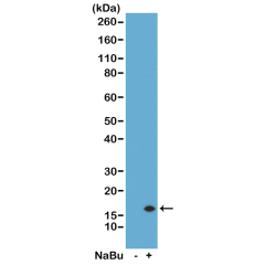 Anti-Acetyl-Histone H3 (Lys14) rabbit monoclonal antibody [RM130] image 1