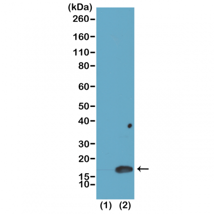 Anti-Dimethyl-Histone H3 (Lys4) Rabbit Monoclonal Antibody [RM135] image 2