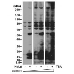 Anti-Acetylated-Lysine rabbit monoclonal antibody [RM101] image 1
