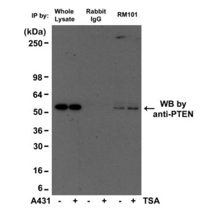 Anti-Acetylated-Lysine rabbit monoclonal antibody [RM101] image 3