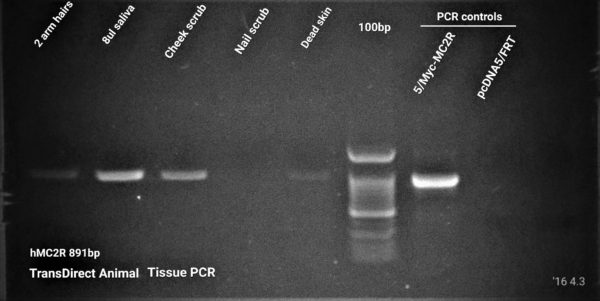 Fig 3 Direct PCR from human body samples