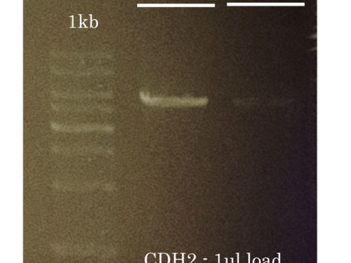 Success #5: Difficult PCR Amplification of CHD2 (long isoform) from human cDNA