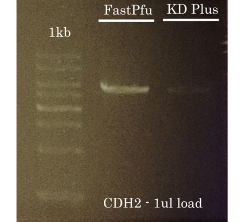 Difficult PCR Amplification of CHD2