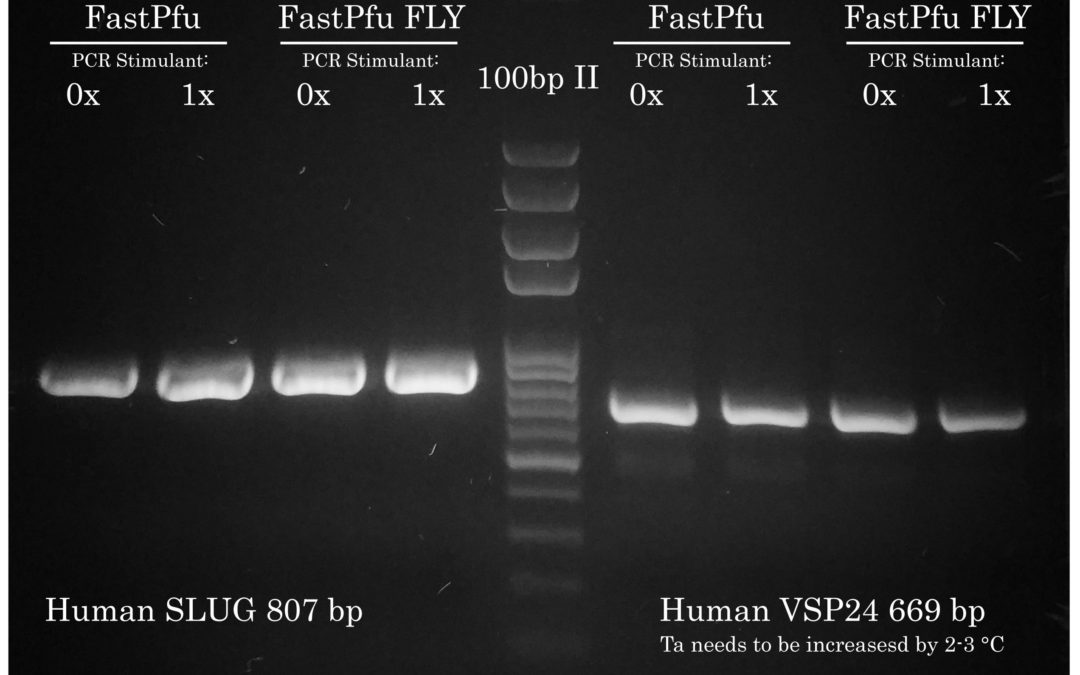 Success #4: Cloning from cDNA: human SLUG, VSP24 and NKCC2