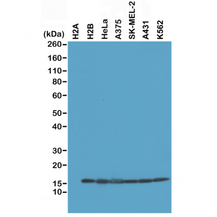 Anti-Histone H2B rabbit monoclonal antibody [RM230] image 2