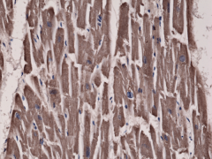 Anti-Acetyl-CoA Carboxylase rabbit monoclonal antibody [RM232] image 1