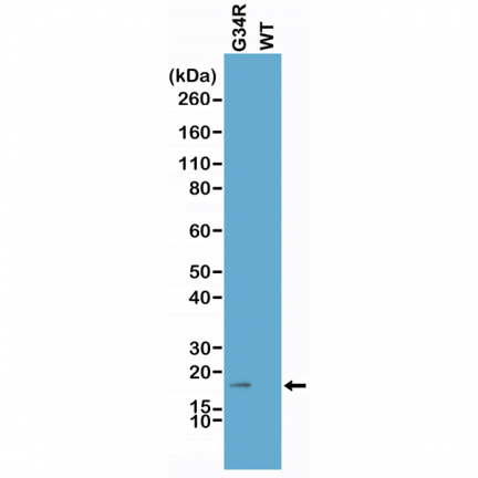 Anti-H3.3G34R  Mutant rabbit monoclonal antibody [RM240] image 2