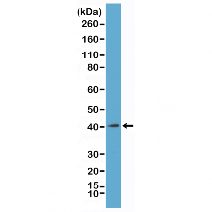 Anti-Core Histone Macro-H2A.1 (H2AFY) rabbit monoclonal antibody [RM248] image 2