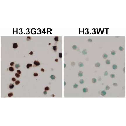 Anti-H3.3G34R Mutant rabbit monoclonal antibody [RM240] image 1
