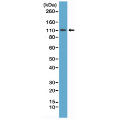 Anti-E-Cadherin (CDH1) rabbit monoclonal antibody [RM244] image 2