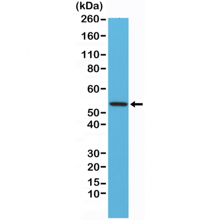 Anti-Desmin (DESM) rabbit monoclonal antibody [RM234] image 2