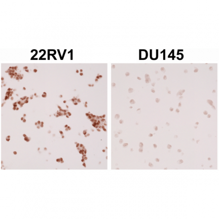 Anti-AR (ARv7 Splice Variant) rabbit monoclonal antibody [RM7] image 2