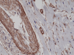 Anti-α-Smooth Muscle Actin (ACTA2) Rabbit Monoclonal Antibody, Clone RM253 image 1