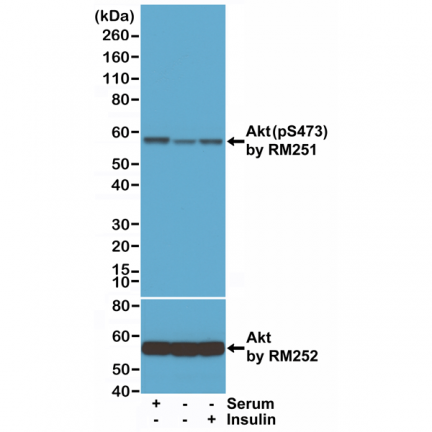 Anti-phospho-Akt (Ser473) Rabbit Monoclonal Antibody, Clone RM251 image 2
