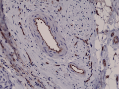 Anti-CD31 (PECAM-1) Rabbit Monoclonal Antibody, Clone RM247 image 1