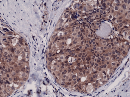 Anti-Caspase-3 Rabbit Monoclonal Antibody, Clone RM250 image 1