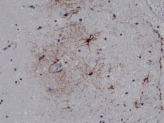 Anti-GFAP Rabbit Monoclonal Antibody, Clone RM246 image 1