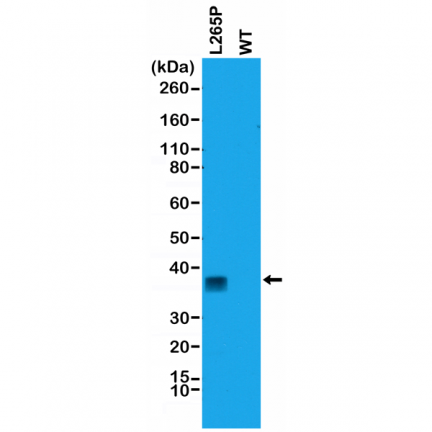 Anti-MYD88 (L265P) Rabbit Monoclonal Antibody, Clone RM5 image 2