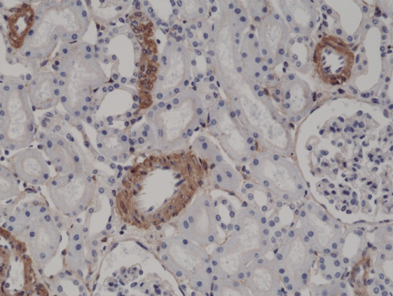 Anti-α-Smooth Muscle Actin (ACTA2) Rabbit Monoclonal Antibody, Clone RM253 image 3