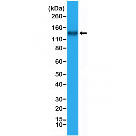 Anti-CD31 (PECAM-1) Rabbit Monoclonal Antibody, Clone RM247 image 2