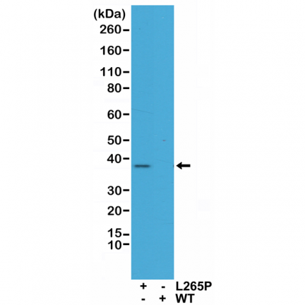 Anti-MYD88 (L265P) Rabbit Monoclonal Antibody, Clone RM5 image 3