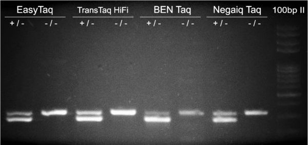 PCR DsRED Easy vs TTaqHiFi vs NEB vs Qiagen Taq DNA Polymerase Comparison
