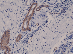 Anti-CD146 Rabbit Monoclonal Antibody, Clone RM249 image 1