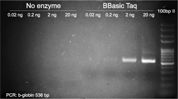 PCR b-globin: Detection Limit of Taq Sigma vs Biobasic