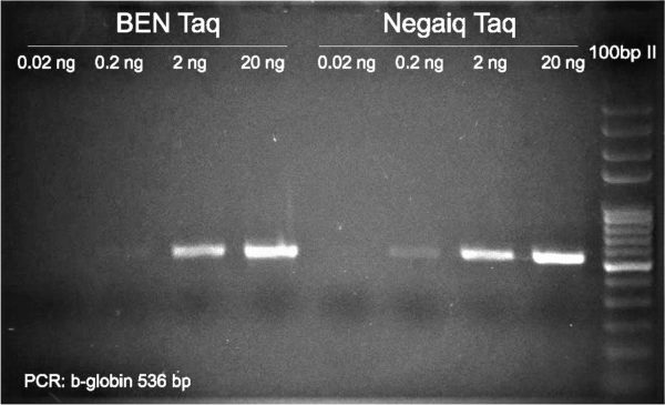 PCR b-globin: Detection Limit of Taq NEB vs Qiagen