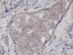 Anti-CD44 Rabbit Monoclonal Antibody [RM264] image 1