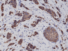 Anti-CK8 (Cytokeratin-8) Rabbit Monoclonal Antibody [RM266] image 1