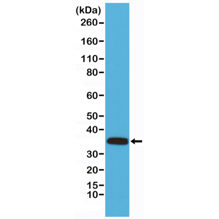 Anti-Calponin-1 Rabbit Monoclonal Antibody [RM262] image 2
