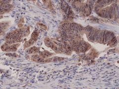 Anti-p16INK4a (CDKN2A) Rabbit Monoclonal Antibody [RM267] image 1